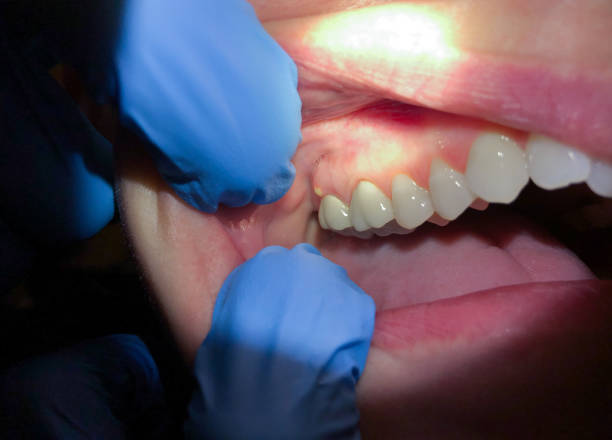 Best Emergency Tooth Extraction  in Central, SC