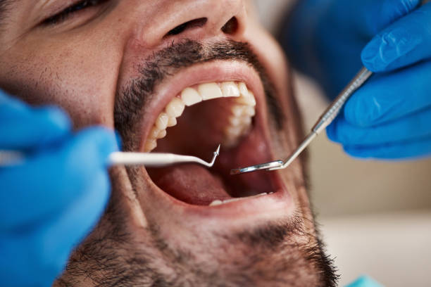 Best Dentist for Tooth Abscess  in Central, SC